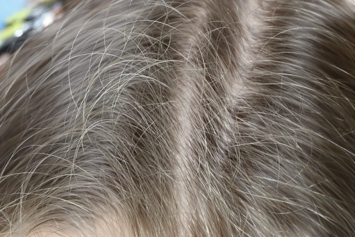 Quanti capelli si perdono al giorno? Quando preoccuparsi