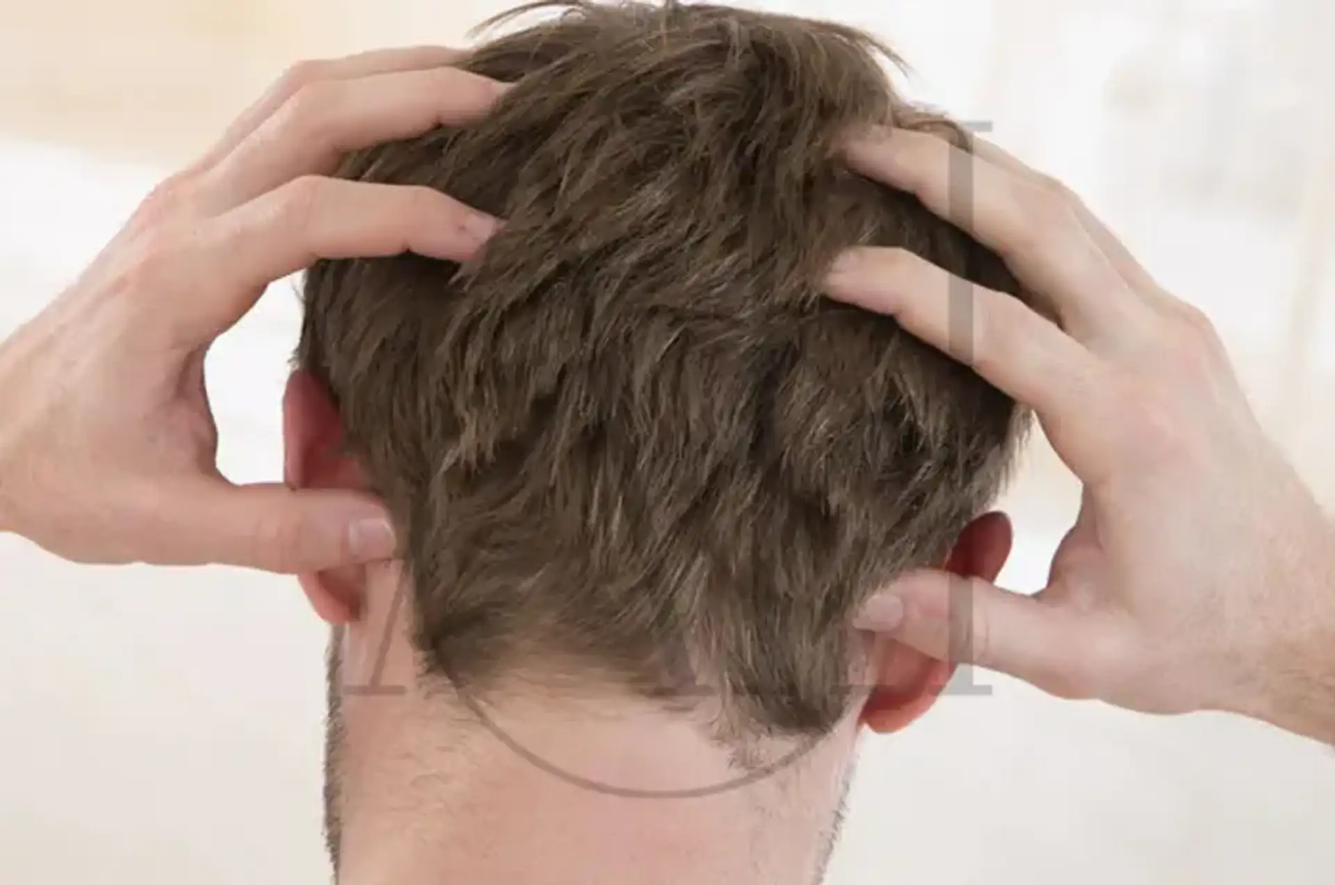 How to Fix Dry Scalp Signs Causes and Best Treatments