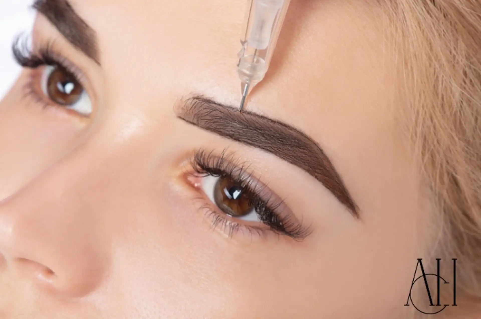 what-are-fue-and-strip -method