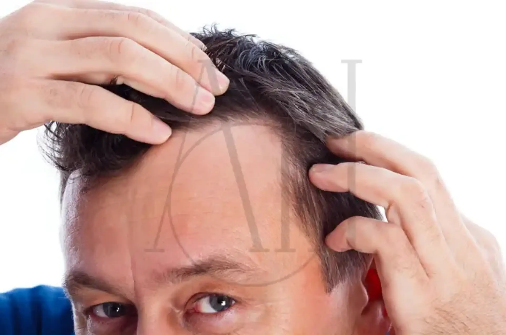 Gestisci lo stress per una migliore crescita dei capelli