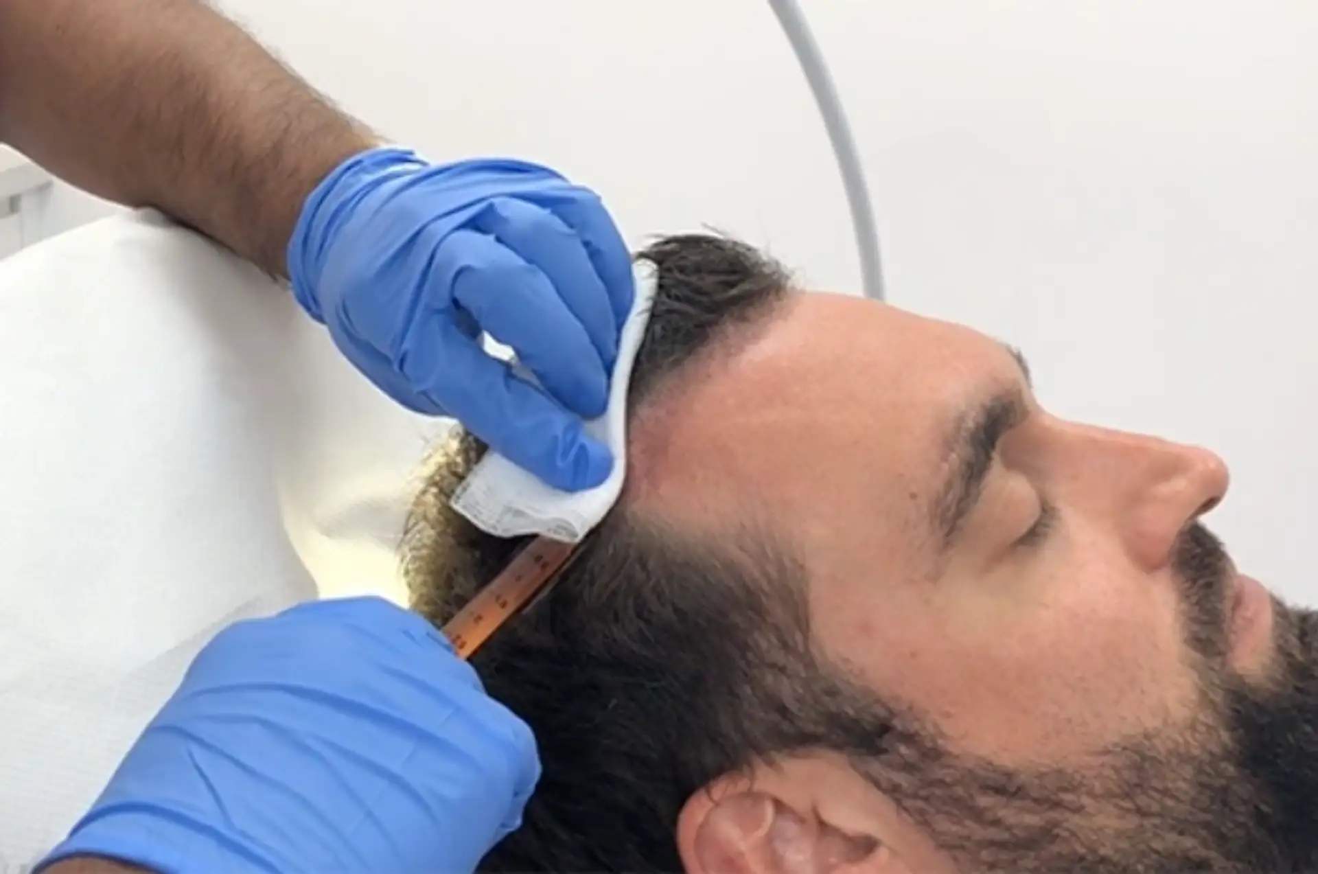 Platelet-Rich Plasma (PRP) Therapy Potential Side Effects