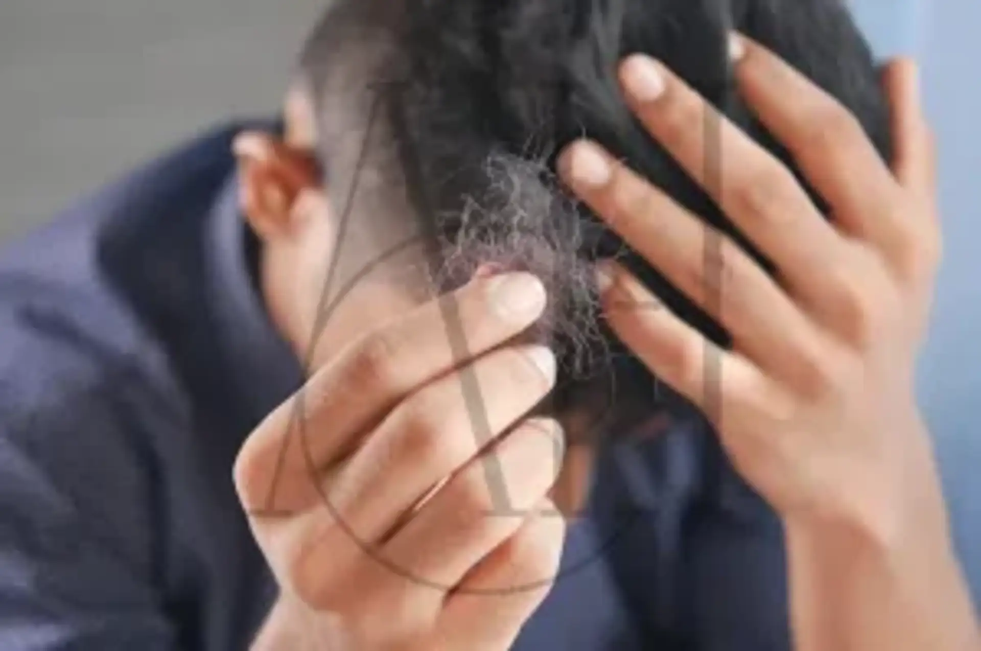 La depressione potrebbe causare la caduta dei capelli?