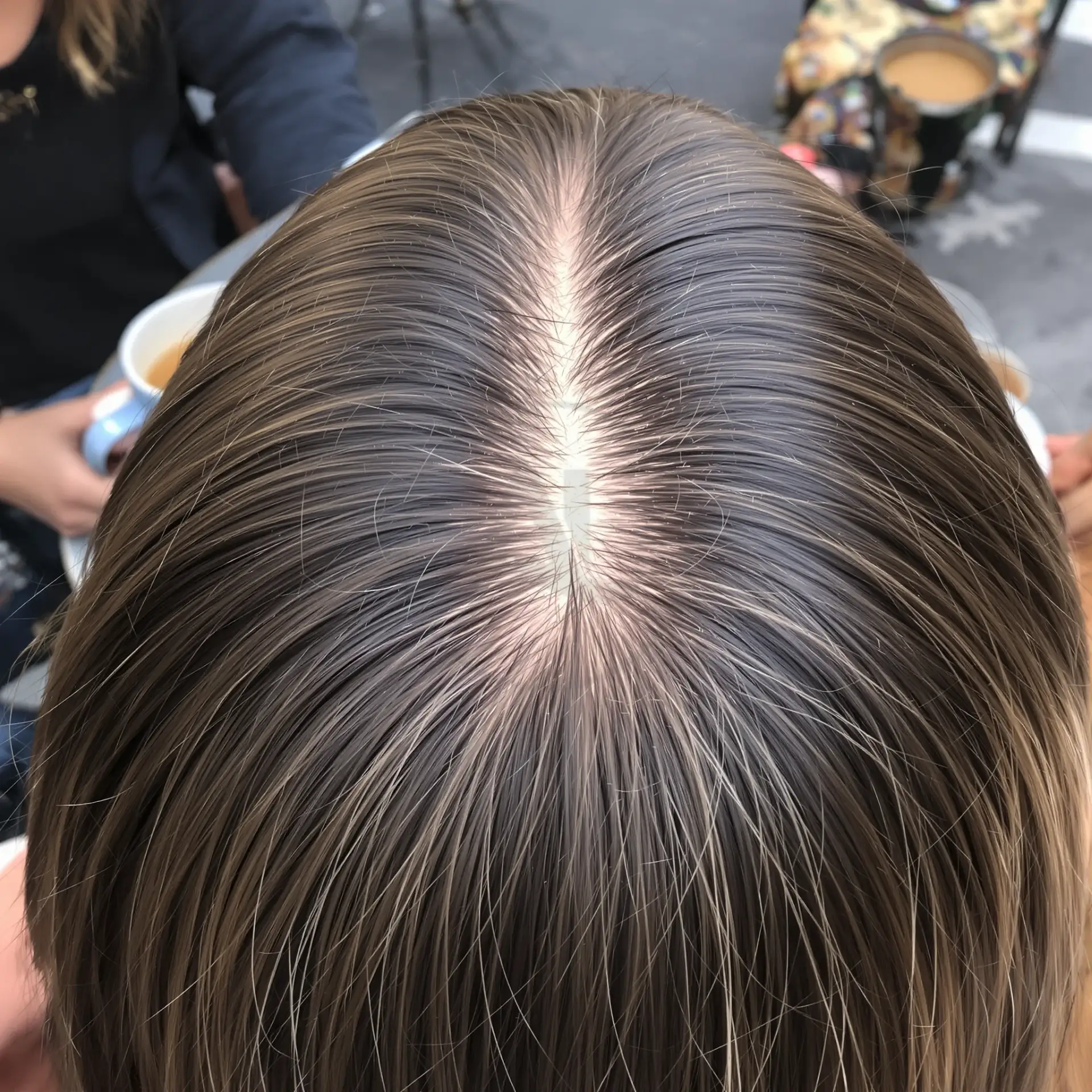 Overhead view of a womans center parting showing a widening scalp gap