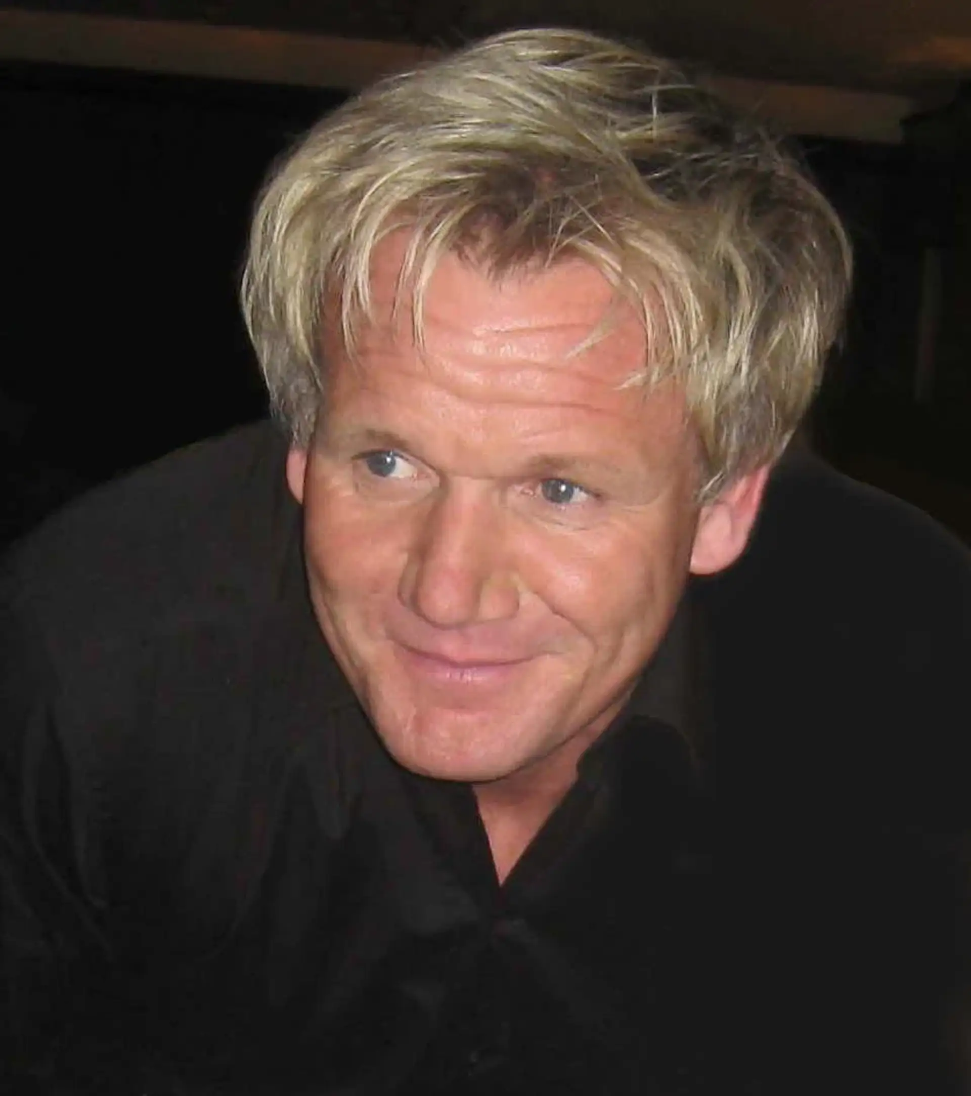 Gordon Ramsay Hair Transplant: What We Know