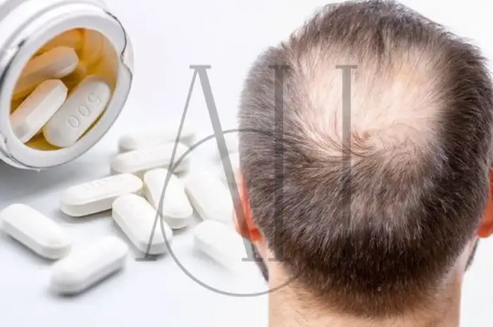 Dutasteride vs Finasteride A Guide to Hair Loss Treatments