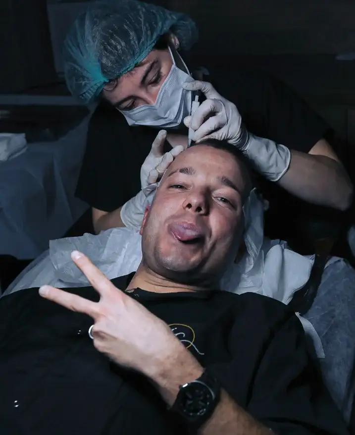 best-options-for-hair-transplant