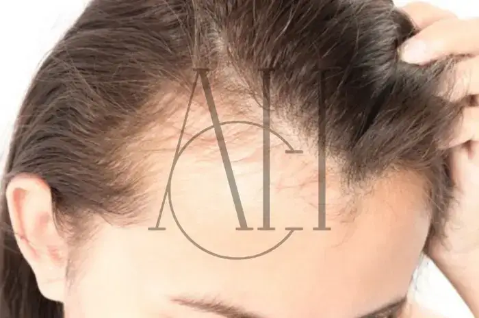 A rriten flokët pas alopecisë nga tërheqja