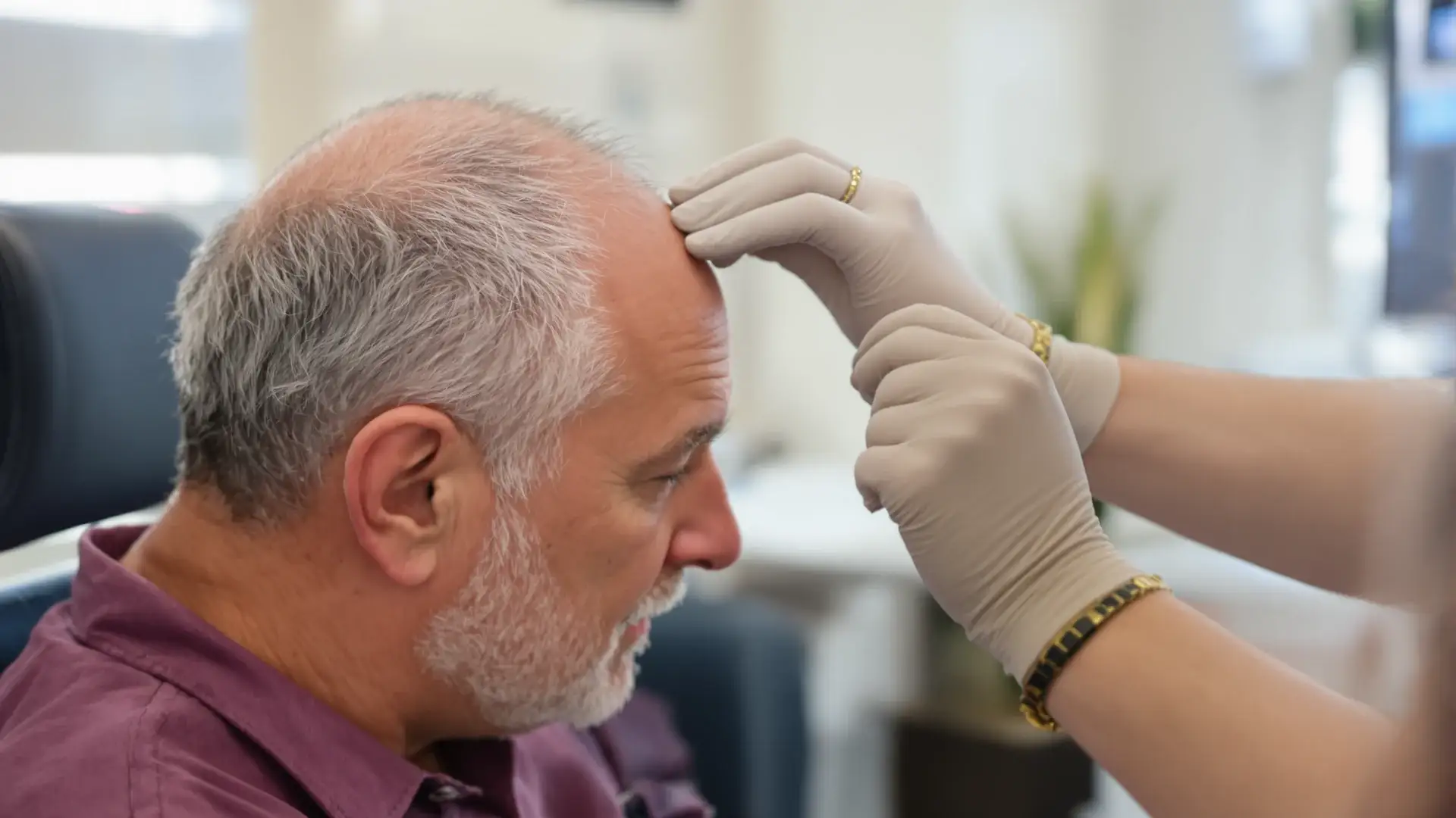Hair transplant consultation at a London clinic