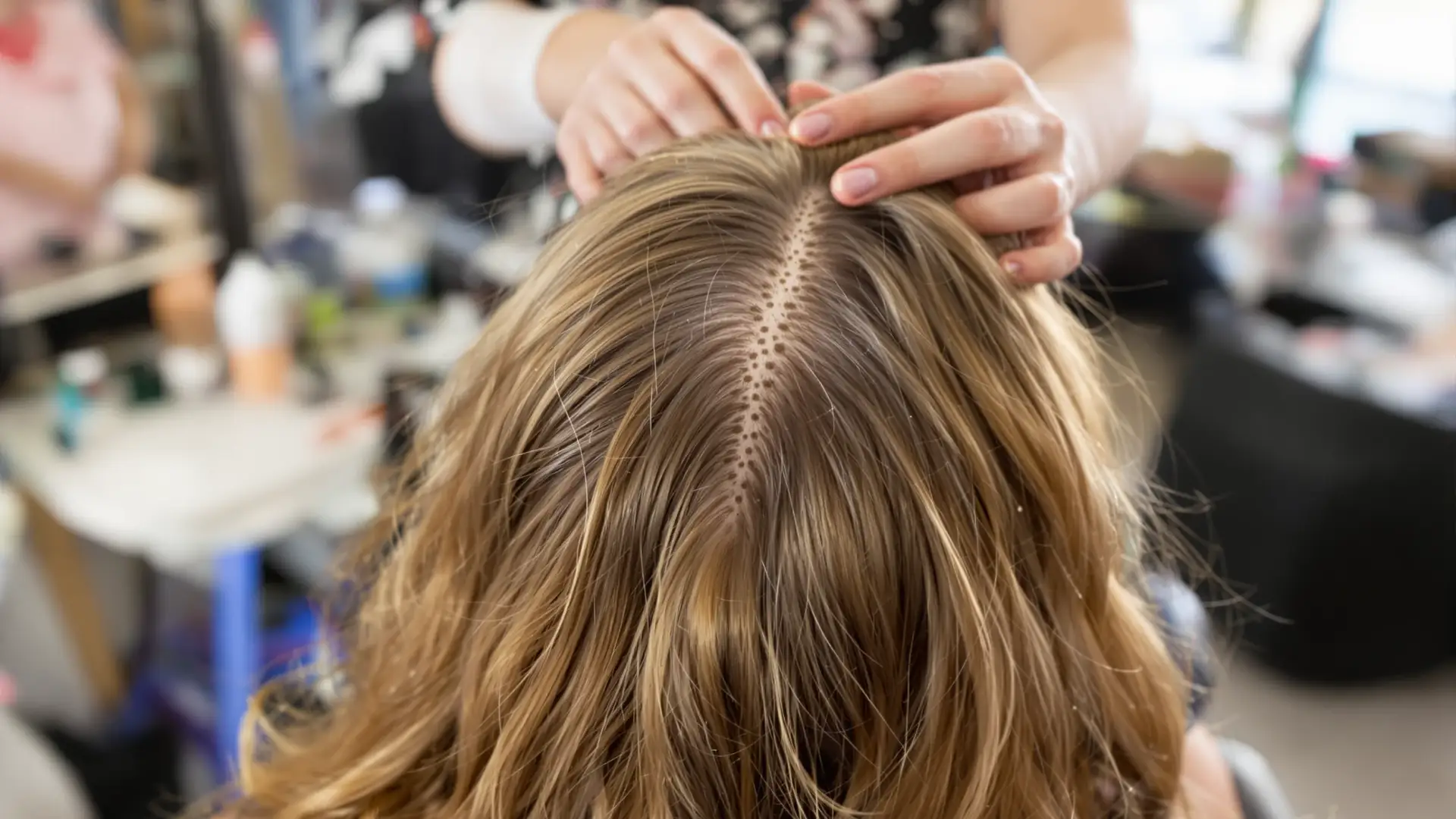 Your Head Has About 100,000 Hair Follicles