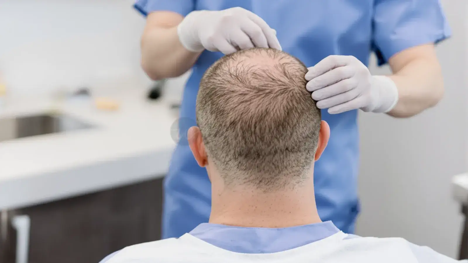 Surgeon examining donor area of balding man in clinic