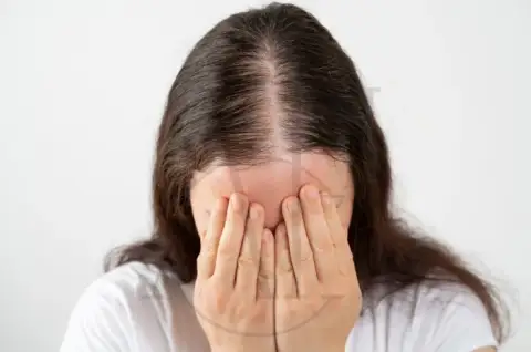 depression-hair-loss.webp