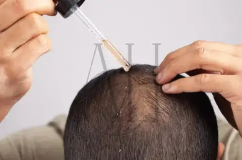 dermatologist-hair-loss-treatment.webp