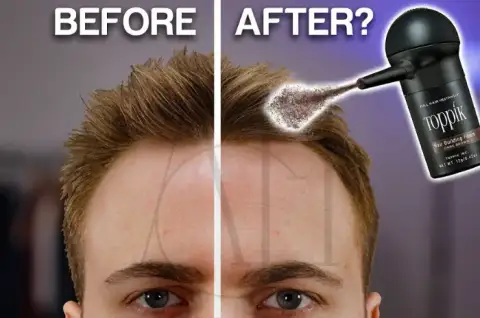fibre per capelli sul cuoio capelluto