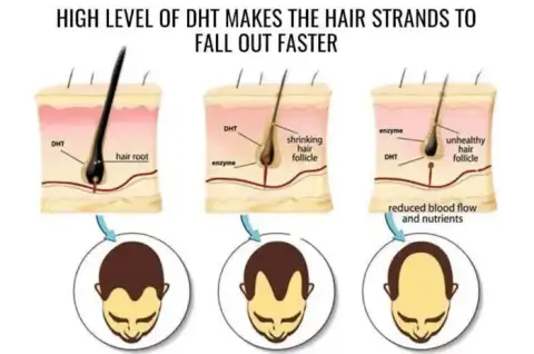 DHT levels in the body
