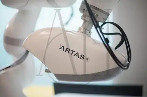 What Is the ARTAS Robotic Hair Transplant System and How It Works (1)