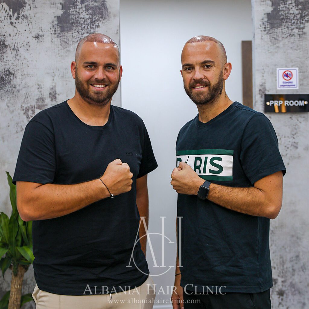 Home - Albania Hair Clinic