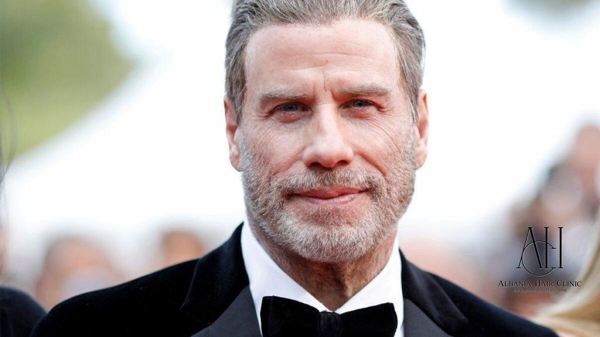 John Travolta Hair Transplant