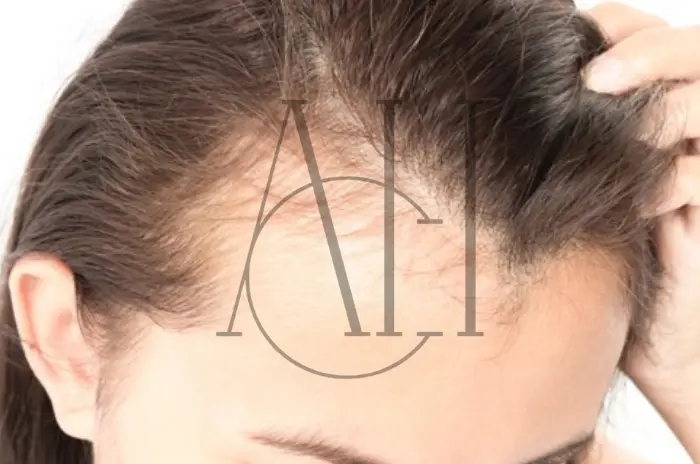 I capelli ricrescono dopo l’alopecia da trazione