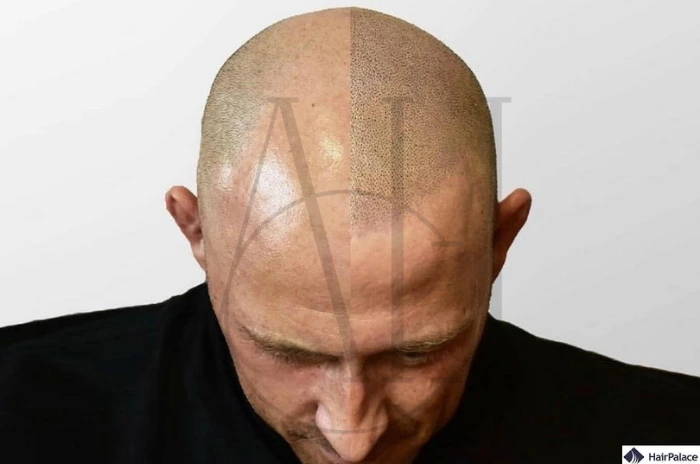 head tattoos for men
