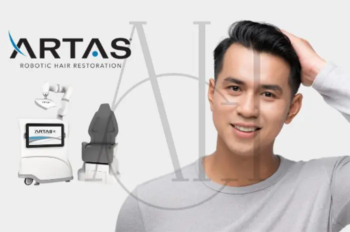 What is ARTAS Robotic Hair Transplantation_