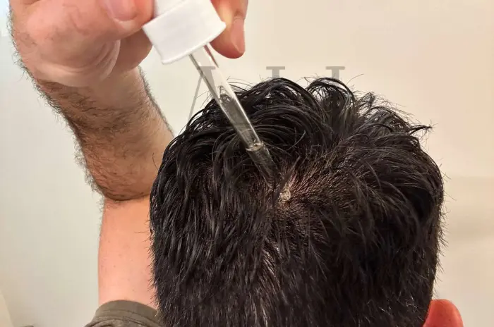 Hair Growth Serums Hair Loss Treatments