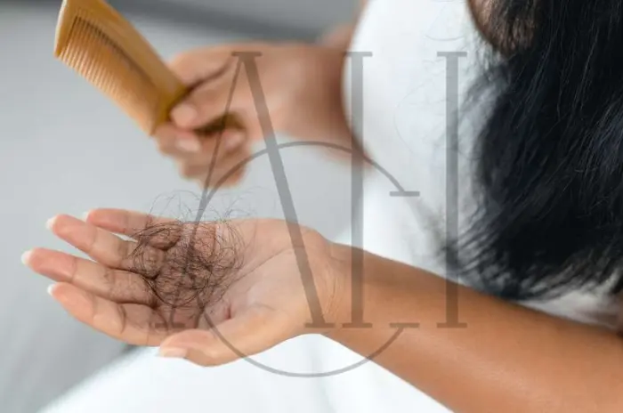 Hormonal Hair Loss- Causes, Treatments
