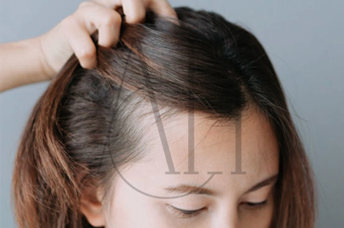 Hair loss causes