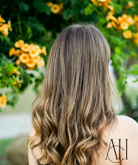 Women Hair Transplant in Tirana